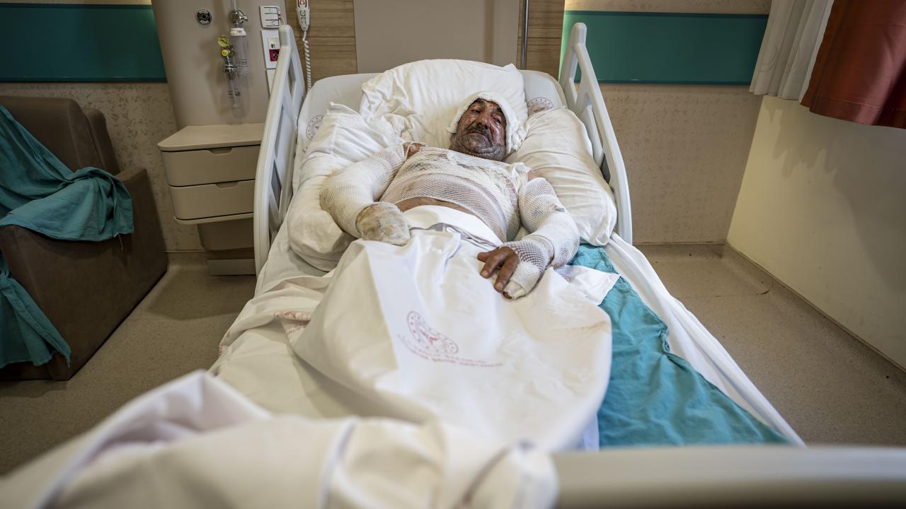Kars'ta sigarayla girilen evde benzin yangını: Çift yaralı