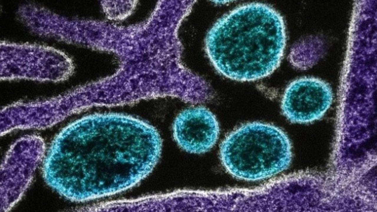 Louisiana'da beyin yiyen amip vakası: 8 yaşındaki kız çocuğu hayatını kaybetti